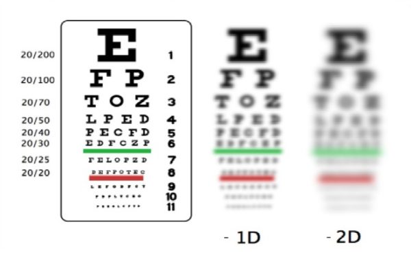 Kiểm tra thị lực với các bảng chữ cái đo mắt